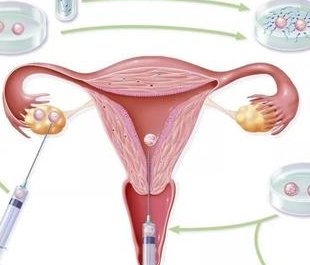 山东的医院试管婴儿好哪家医院试管成功率高