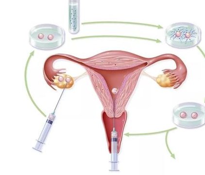 成都三胎政策新消息！在成都进行试管婴儿生三胎需要满足哪些条件？